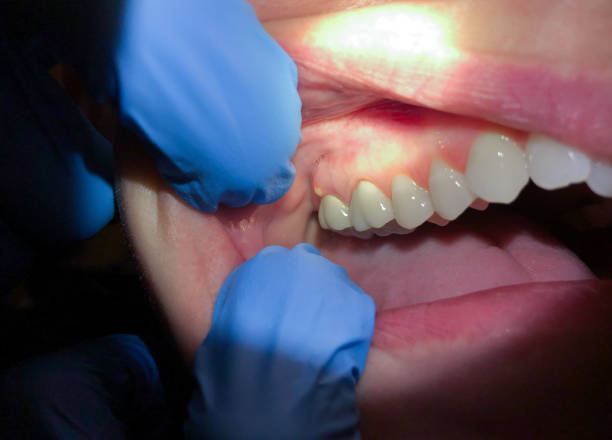 Best Emergency TMJ Treatment in Minster, OH