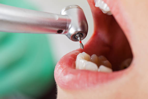 Best Emergency Denture Repair in Minster, OH